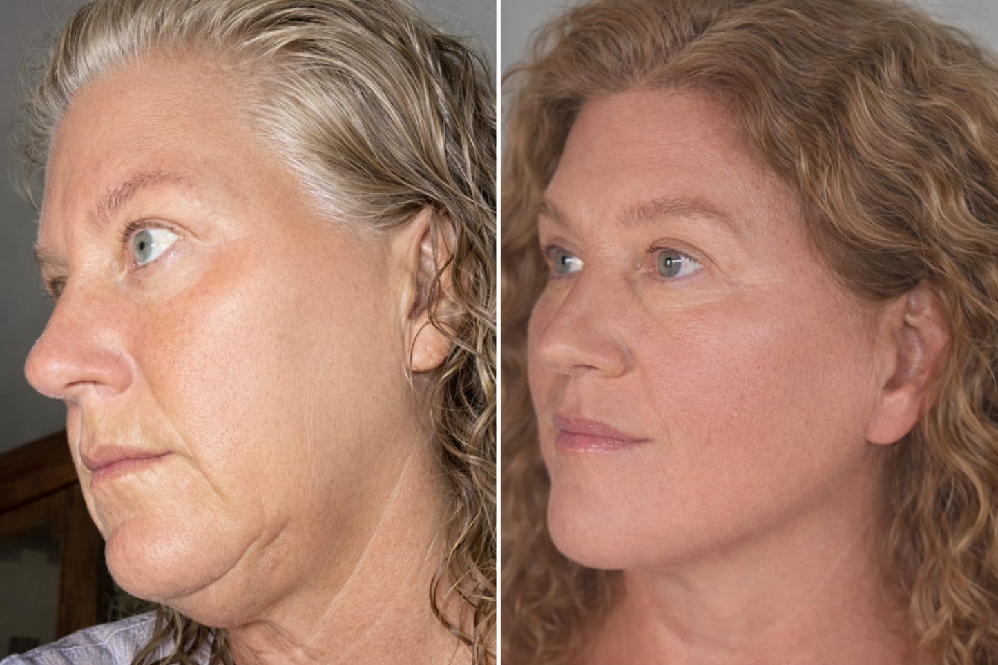 Limfatikus nyirok kefe